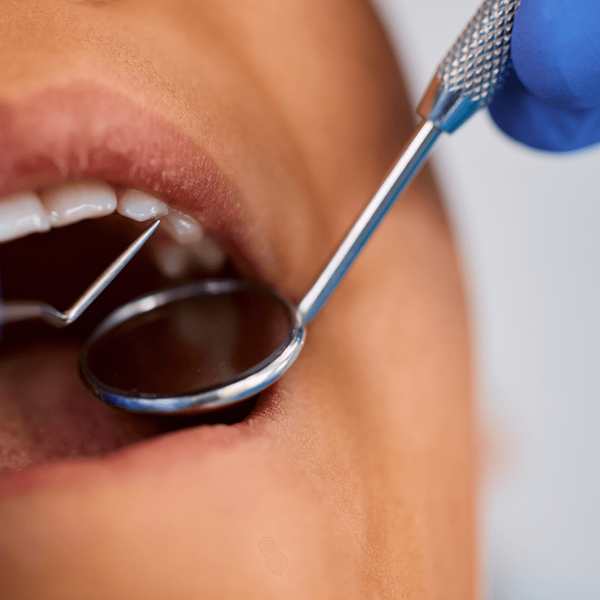 Dentiste faisant un détartrage sur une patiente